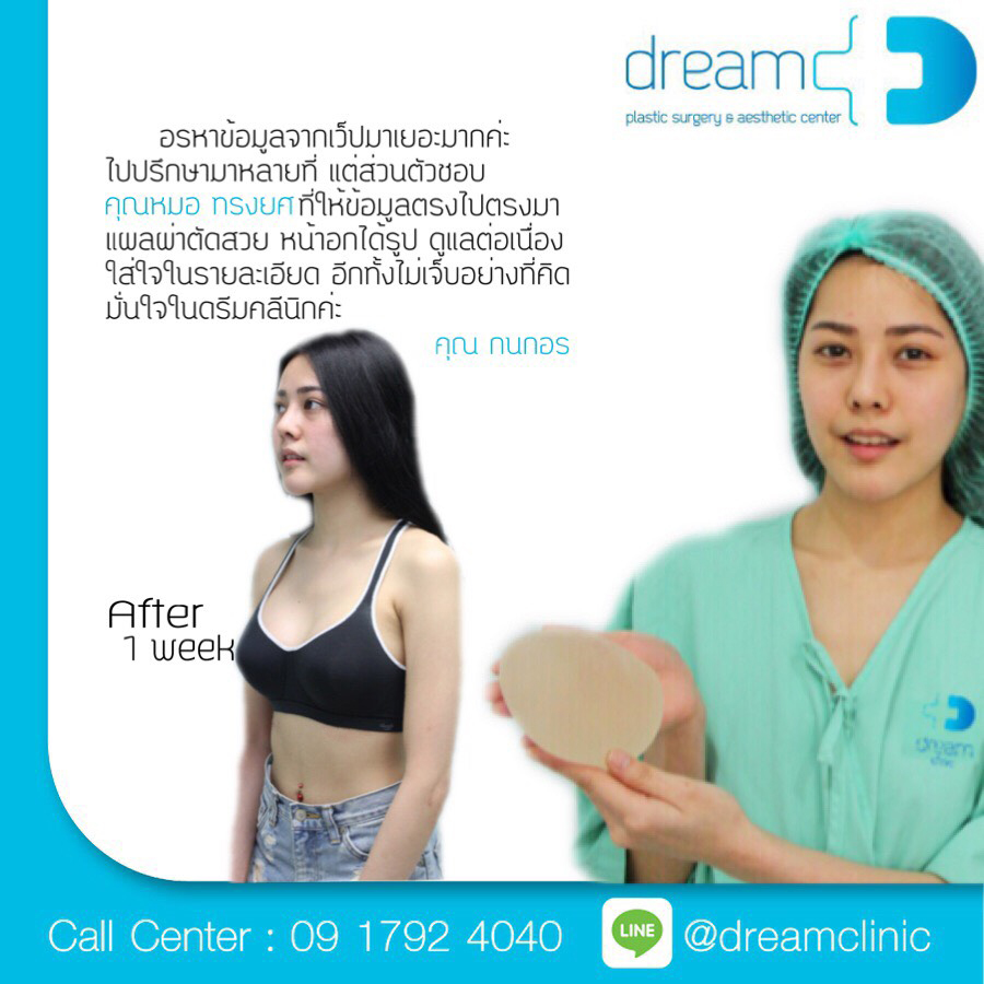 Breast Augmentation_24 – BCOSS Clinic : Cosmetic Surgery Bangkok